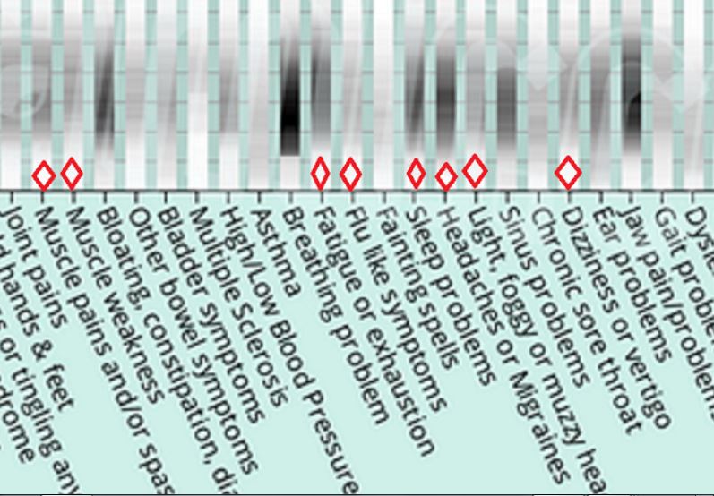 Fibromyalgia graph.JPG