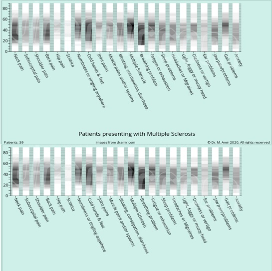 Graph JAW MS.jpg